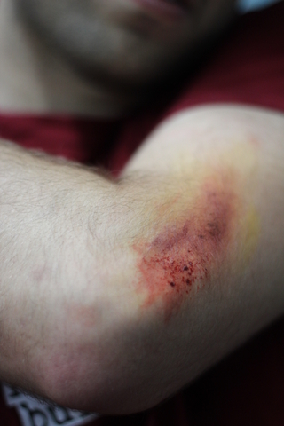 Wound makeup class
